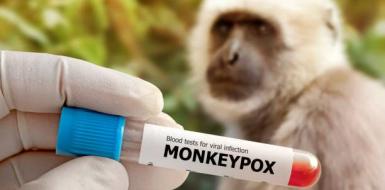 О профилактике оспы обезьян