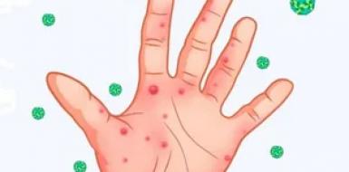 Профилактика энтеровирусной инфекции